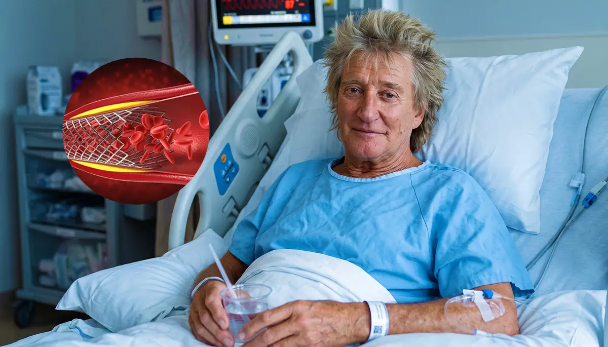 Rod Stewart fue sometido a un procedimiento cardíaco tras detectar una obstrucción
